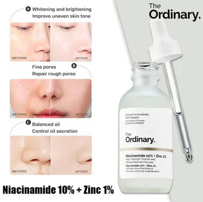 The Ordinary Niacinamide Serum 10% + Zinc 1% Supersize Serum [Buy 1 Get 1 Free] | Best Quality Serum 30ML