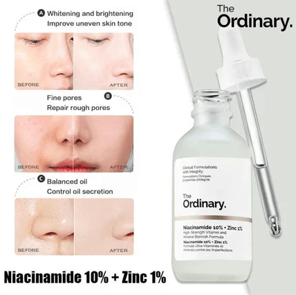 The Ordinary Niacinamide Serum 10% + Zinc 1% Supersize Serum [Buy 1 Get 1 Free] | Best Quality Serum 30ML